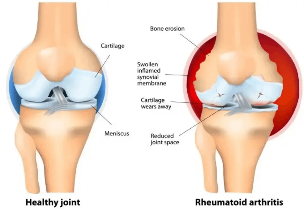 Cartilage Explain